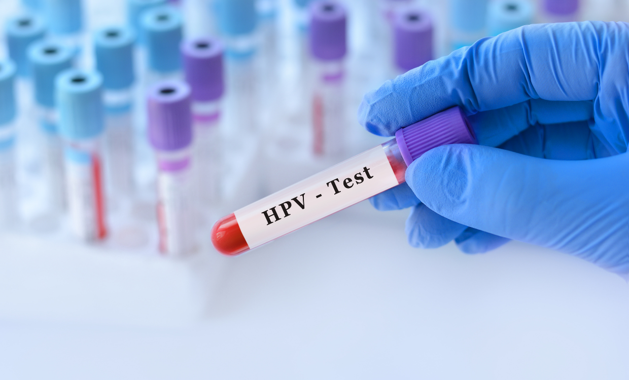 HPV ve Tedavisinde Krioterapi: Detaylı Bir İnceleme