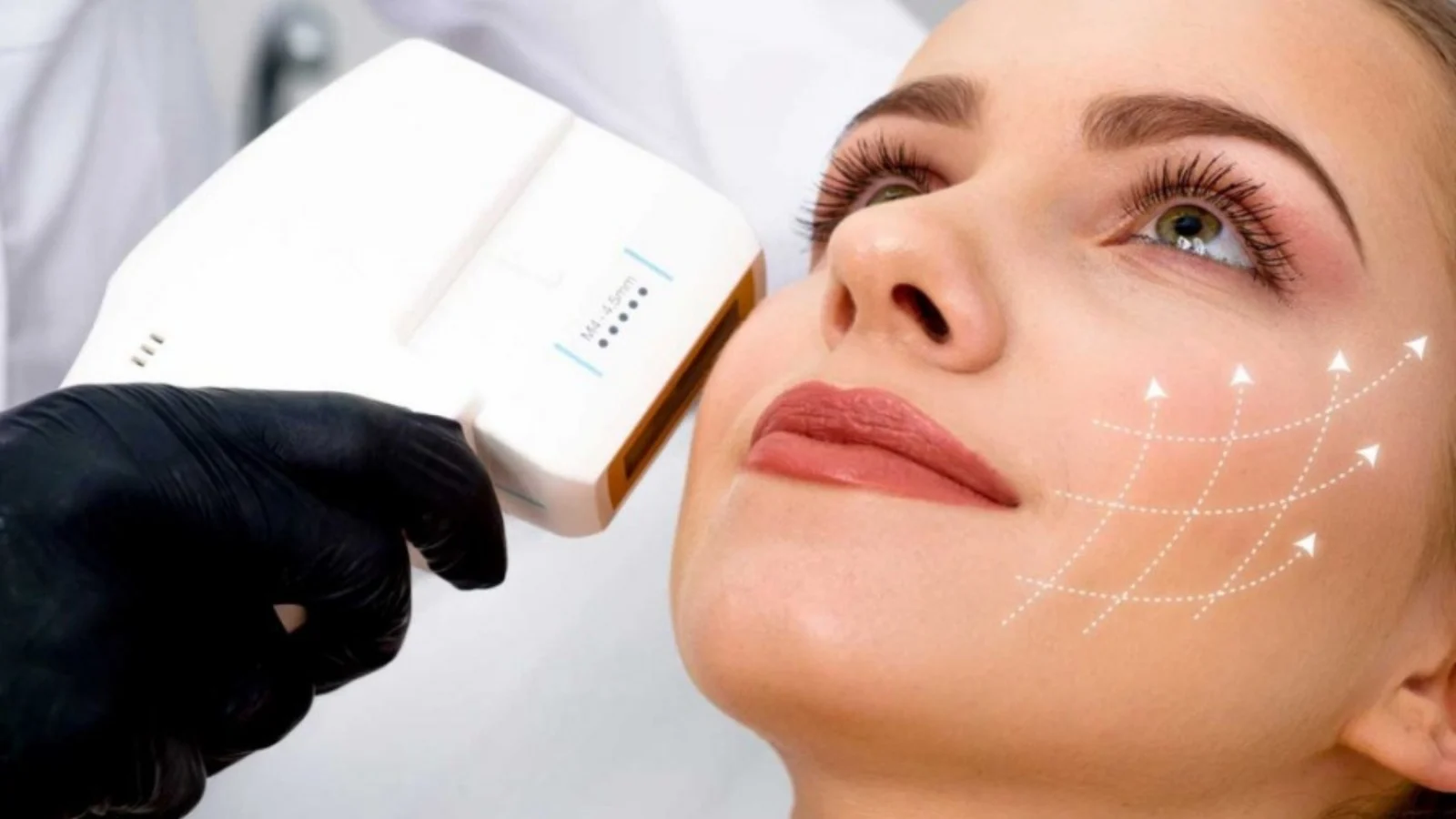 Fokuslu Ultrason: Teknolojinin Sağlığa Getirdiği Yenilik 1 Fokuslu Ultrason