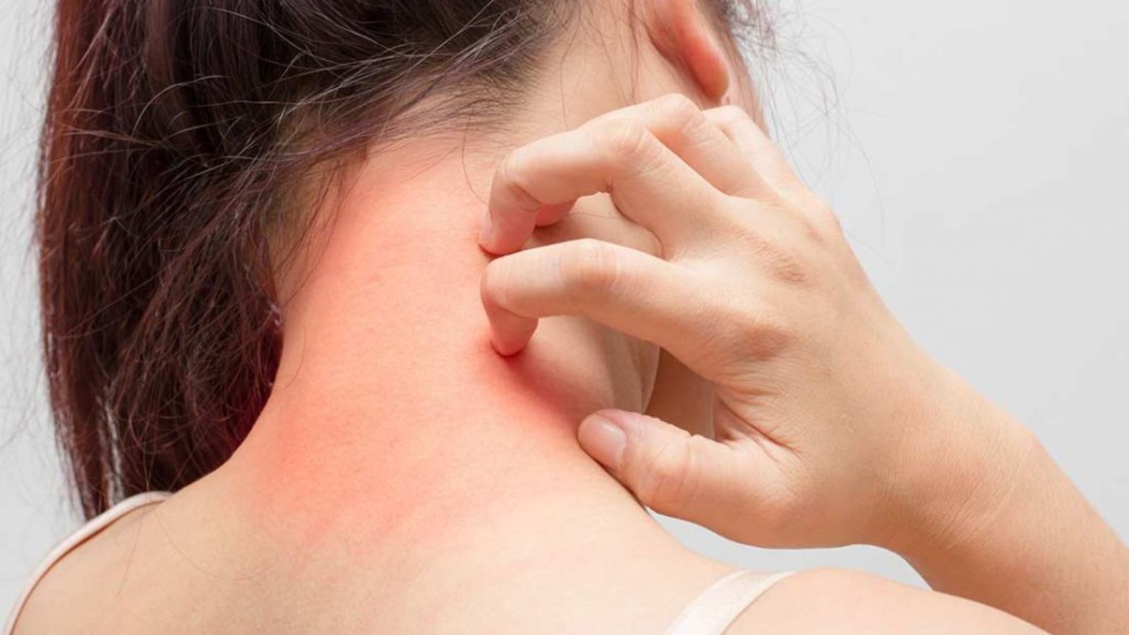 Cilt Hastalıkları 15 Kaşıntı (Pruritus)