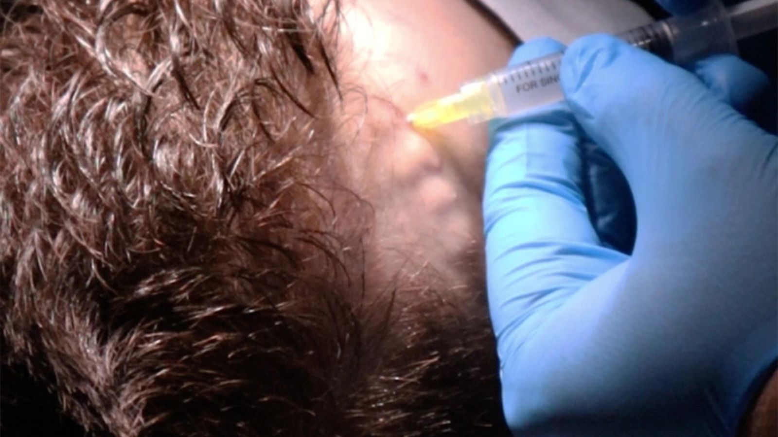 Dermokozmetik Uygulamalar 29 Regenera Activa