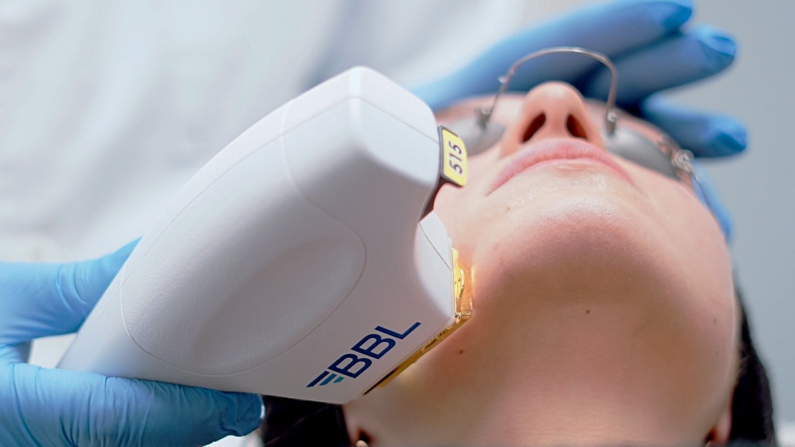 Dermokozmetik Uygulamalar 4 BBL IPL Lazer (Yoğun Atımlı Işık Teknolojisi)