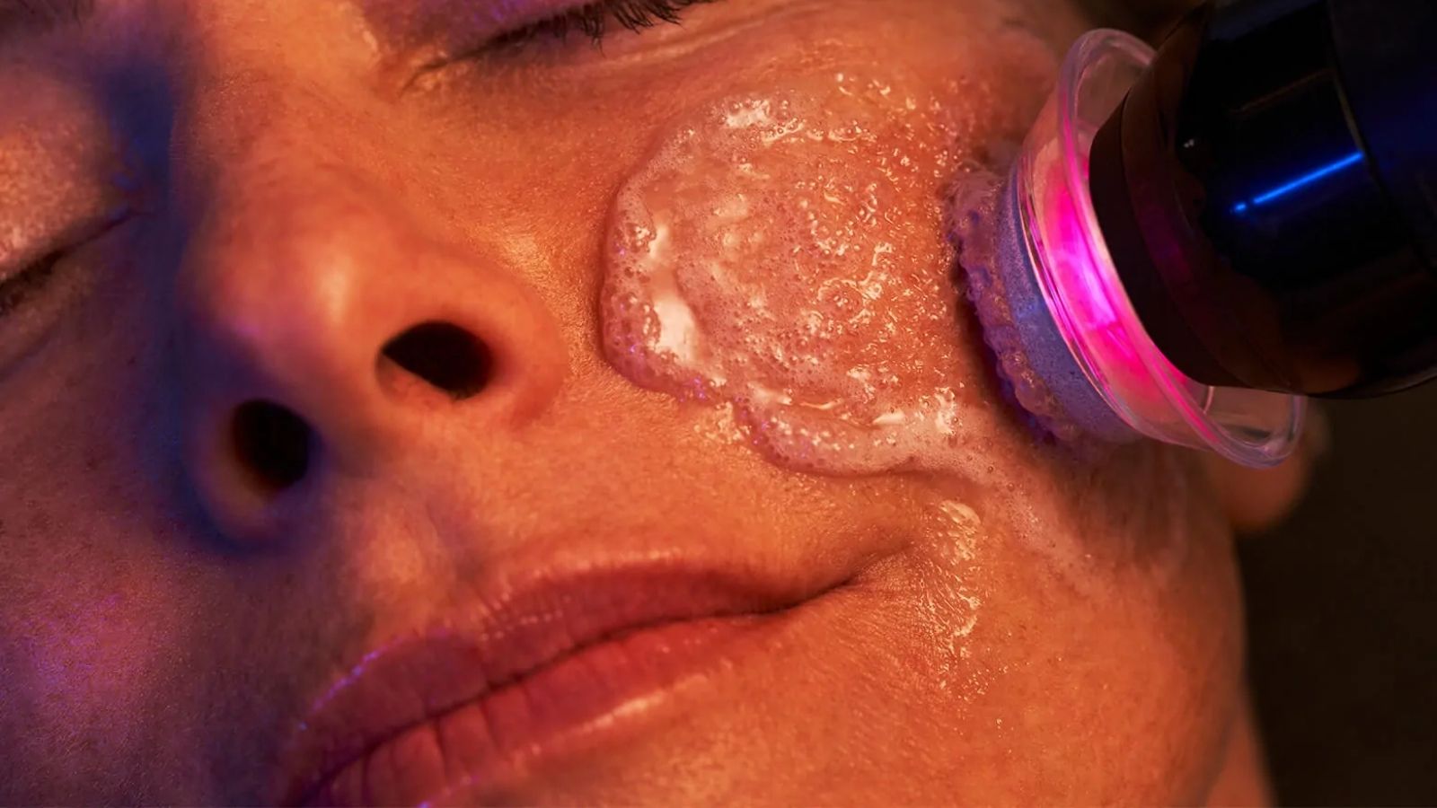 Dermokozmetik Uygulamalar 20 Bubble Terapi