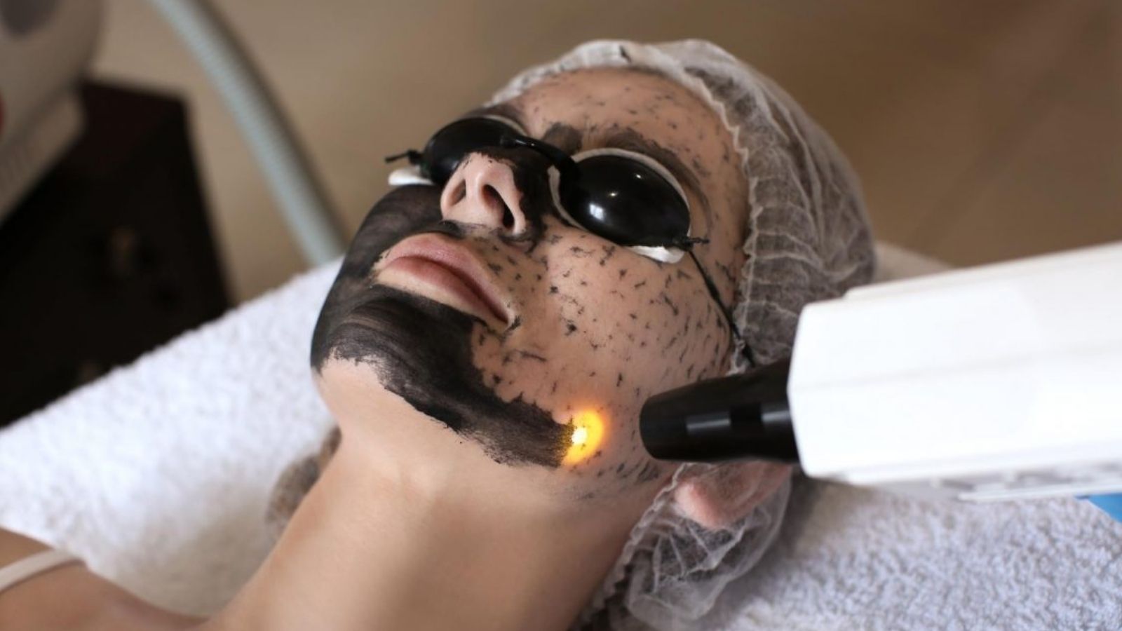 Dermokozmetik Uygulamalar 18 Karbon Peeling