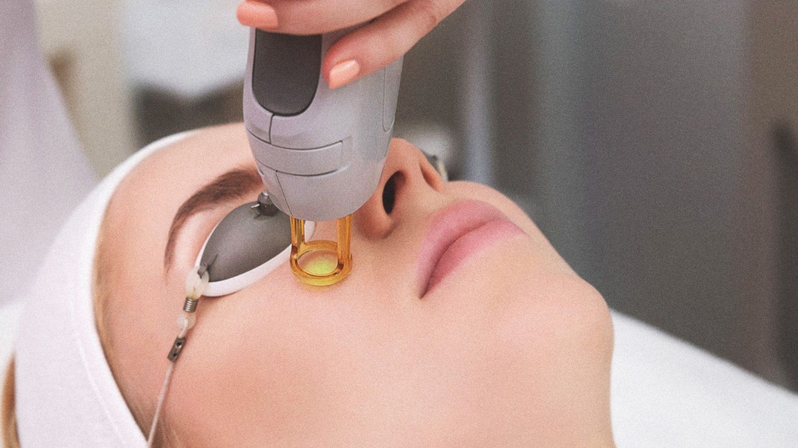 Dermokozmetik Uygulamalar 5 Q-Switched lazer